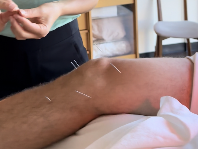 acupuncture for knee pain in san Diego