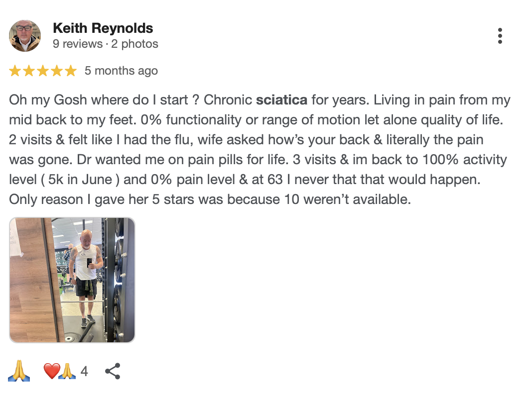 Acupuncture for Sciatica pain relief San Diego